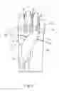 Fig. 03 - Glove