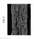 Fig. 07 - Fluoropolymer Article For Bacterial Filtration