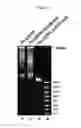 Fig. 05 - Linear valve arrays