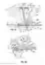 Fig. 07 - System, nozzle and method for coating elastic strands
