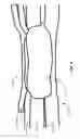 Fig. 07 - Method and apparatus for resistive spot welding