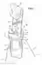 Fig. 03 - Method and apparatus for installing a hanger clip