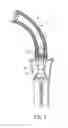 Fig. 07 - SAW SHEATH THAT FACILITATES REMOVAL OF THE SAW