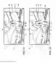 Fig. 08 - Vertically adjustable vehicle seatback