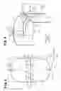 Fig. 06 - Side airbag apparatus