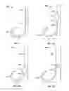 Fig. 02 - Elasmobranch-repelling magnets and methods of use