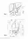 Fig. 04 - Front frame for a cascade thrust reverser structure