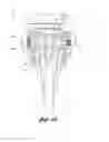 Fig. 10 - Plastic beer keg