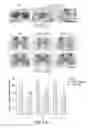 Fig. 12 - Therapeutic Use of the Encoding Sequence of the Carboxy-Terminal Domain of the Heavy Chain of the Tetanus Toxin