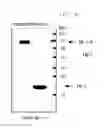 Fig. 05 - Use of mutant haptoglobin having angiogenesis promoting activity