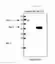 Fig. 07 - Use of mutant haptoglobin having angiogenesis promoting activity