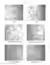Fig. 10 - Use of mutant haptoglobin having angiogenesis promoting activity