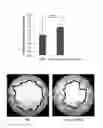 Fig. 12 - Use of mutant haptoglobin having angiogenesis promoting activity