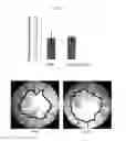 Fig. 13 - Use of mutant haptoglobin having angiogenesis promoting activity