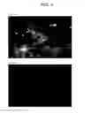 Fig. 05 - COMPOSITIONS AND METHODS FOR DETECTING OR ELIMINATING SENESCENT CELLS TO DIAGNOSE OR TREAT DISEASE