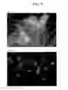 Fig. 06 - COMPOSITIONS AND METHODS FOR DETECTING OR ELIMINATING SENESCENT CELLS TO DIAGNOSE OR TREAT DISEASE