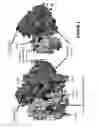 Fig. 02 - Precision medicine for cholesterol treatment