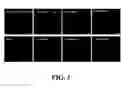 Fig. 04 - Neural progenitor cell differentiation