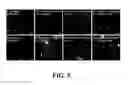 Fig. 06 - Neural progenitor cell differentiation