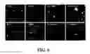 Fig. 07 - Neural progenitor cell differentiation