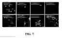 Fig. 08 - Neural progenitor cell differentiation
