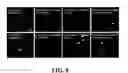 Fig. 09 - Neural progenitor cell differentiation
