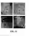 Fig. 12 - Neural progenitor cell differentiation