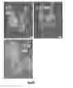 Fig. 25 - IKAROS INHIBITION TO AUGMENT ADOPTIVE T CELL TRANSFER