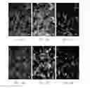 Fig. 08 - INDIVIDUALIZED HIGH PURITY HEPATOCELLULAR CARCINOMA STEM CELLS, METHODS AND USE OF THE SAME