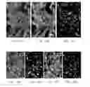 Fig. 09 - INDIVIDUALIZED HIGH PURITY HEPATOCELLULAR CARCINOMA STEM CELLS, METHODS AND USE OF THE SAME