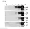 Fig. 03 - TUMOR-SELECTIVE E1A  AND E1B MUTANTS