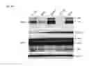 Fig. 07 - TUMOR-SELECTIVE E1A  AND E1B MUTANTS