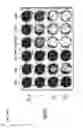 Fig. 40 - TUMOR-SELECTIVE E1A  AND E1B MUTANTS