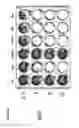 Fig. 43 - TUMOR-SELECTIVE E1A  AND E1B MUTANTS