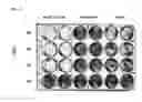 Fig. 46 - TUMOR-SELECTIVE E1A  AND E1B MUTANTS