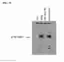 Fig. 48 - TUMOR-SELECTIVE E1A  AND E1B MUTANTS