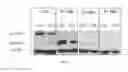 Fig. 12 - HEPARANASE EXPRESSION IN HUMAN T LYMPHOCYTES