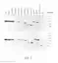 Fig. 04 - Human cystathionine beta-synthase variants and methods of production thereof
