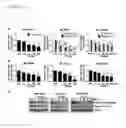 Fig. 03 - PHOSPHORODIAMIDATE MORPHOLINO OLIGOMERS (PMOS) AND THEIR USE IN SUPPRESSION OF MUTANT HUNTINGTIN EXPRESSION AND ATTENUATION OF NEUROTOXICITY