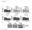 Fig. 04 - PHOSPHORODIAMIDATE MORPHOLINO OLIGOMERS (PMOS) AND THEIR USE IN SUPPRESSION OF MUTANT HUNTINGTIN EXPRESSION AND ATTENUATION OF NEUROTOXICITY