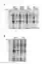 Fig. 04 - Universal protein overexpression tag comprising ramp function, and application thereof