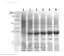 Fig. 06 - Universal protein overexpression tag comprising ramp function, and application thereof