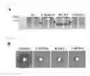 Fig. 10 - Universal protein overexpression tag comprising ramp function, and application thereof
