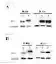 Fig. 15 - Universal protein overexpression tag comprising ramp function, and application thereof