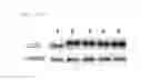 Fig. 16 - Universal protein overexpression tag comprising ramp function, and application thereof