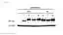 Fig. 17 - Universal protein overexpression tag comprising ramp function, and application thereof