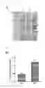 Fig. 18 - Universal protein overexpression tag comprising ramp function, and application thereof