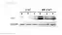 Fig. 19 - Universal protein overexpression tag comprising ramp function, and application thereof