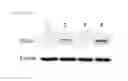 Fig. 20 - Universal protein overexpression tag comprising ramp function, and application thereof