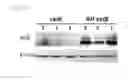 Fig. 22 - Universal protein overexpression tag comprising ramp function, and application thereof